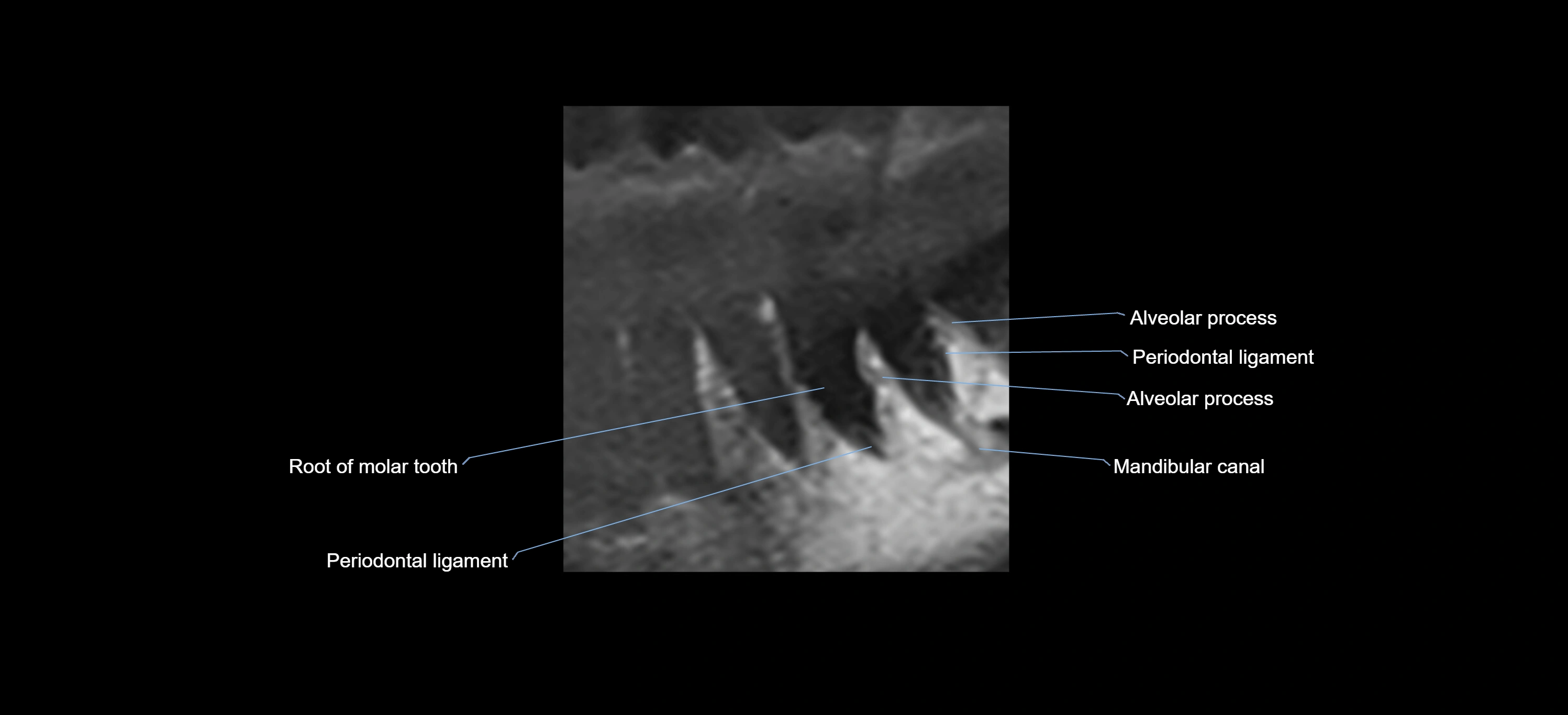 MRI tooth sagittal micro cross sectional 3T labelled anatomy image-00001.webp